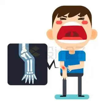 卡通男孩骨折手臂受伤露出痛苦表情8351055矢量图片免抠素材