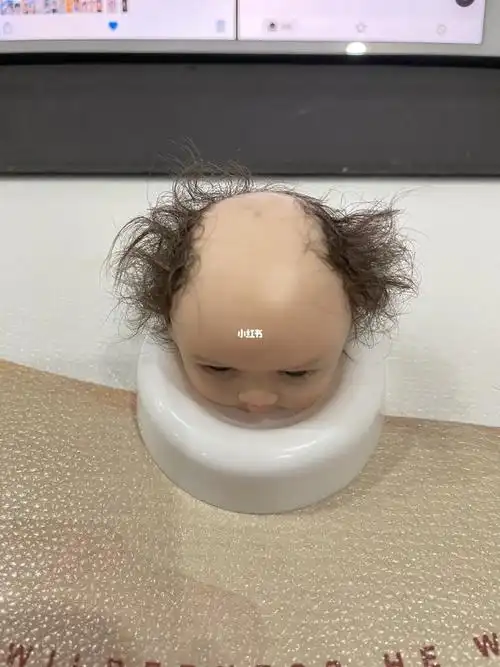 右滑给这个秃头小宝贝植发