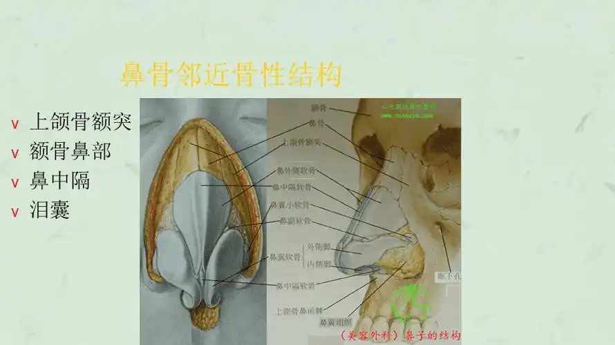 讲课鼻骨骨折课件