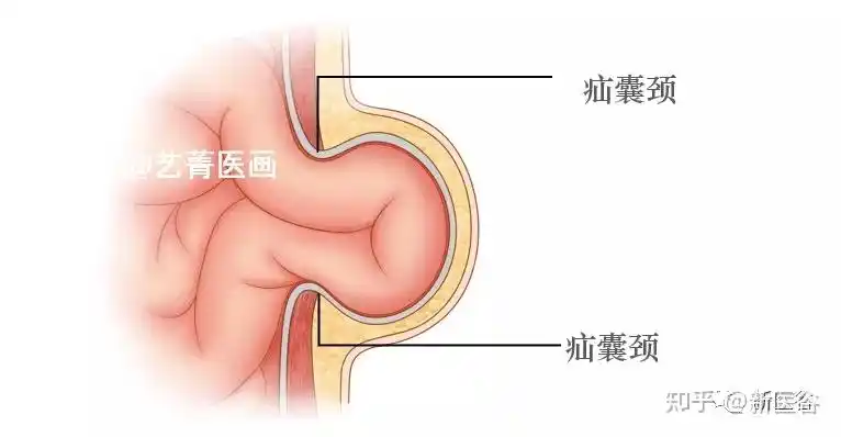 跟谷谷一起看病案学外科腹股沟疝五腹股沟区b超检查