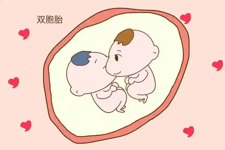 双胞胎是怎么形成的(一个孕囊双胞胎先兆)_环球信息网