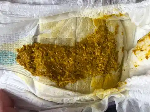 再有两天就出月子了,宝宝今天大便中感觉有条状的东西,正常吗?