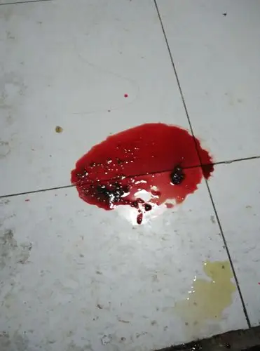 今天早上是拉稀,到下午就变成拉血了,到晚上就是那个单独的血那个样子