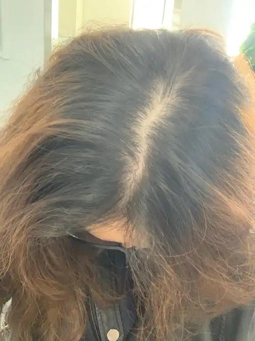 女生这样头顶正常吗