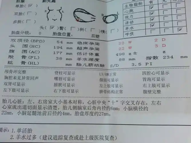 羊水深度的羊水指数