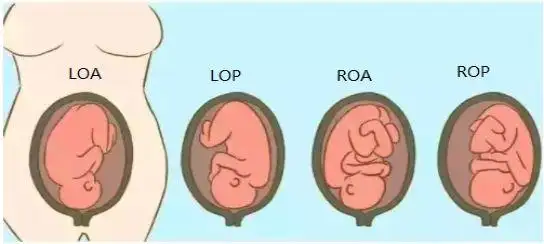1,b超通过b超主要观察胎儿的生理指标,胎位,羊水,脐带及胎盘等情况.
