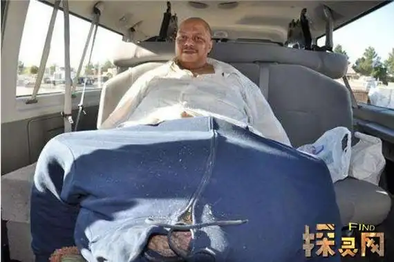 世界上最大的睾丸韦斯利沃伦睾丸重达120斤图片