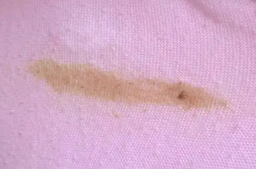 艾灸新手必须知道的4大技能-健康频道-手机搜狐