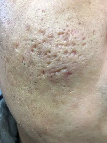 爱问健康_姚庆君__爱问健康