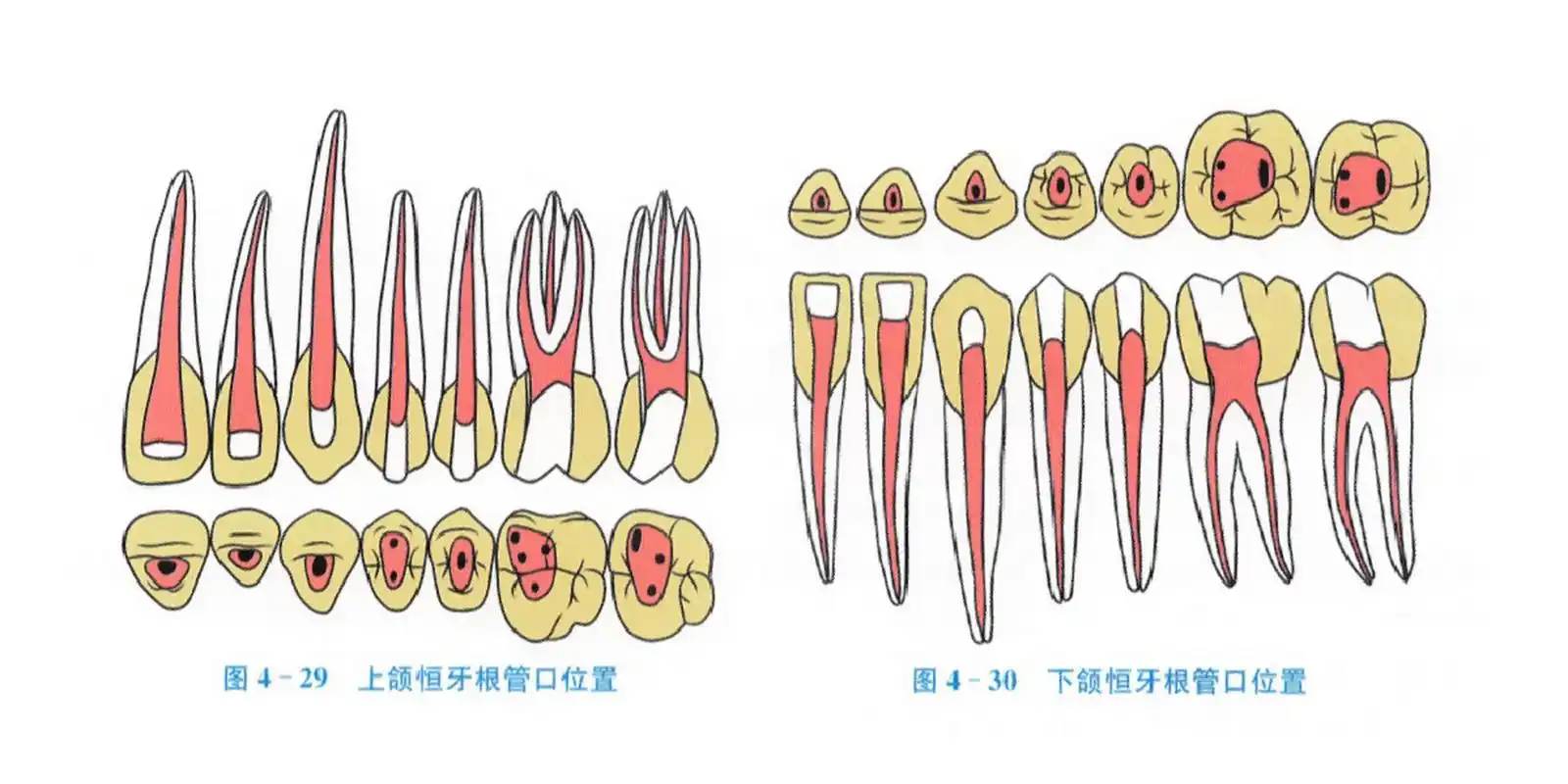 根管口的位置图谱