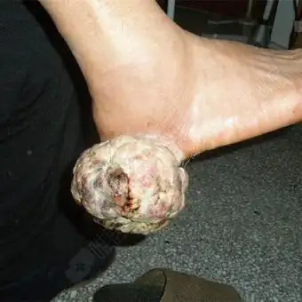 纠错 · 举报 已有人评分