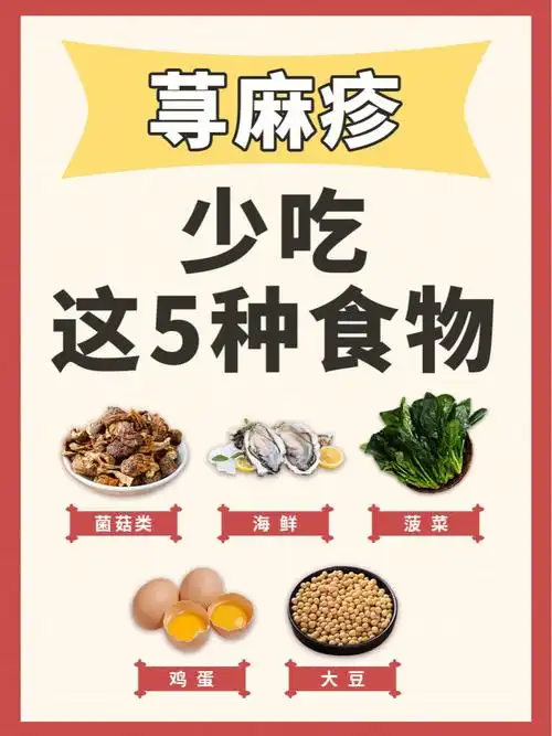 荨麻疹少吃五类食物这些护理得知识6015