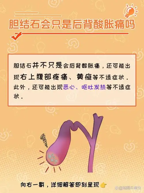 胆结石的症状多种多样,容易被人们忽视.