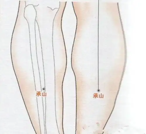 中医推拿梨状肌综合征