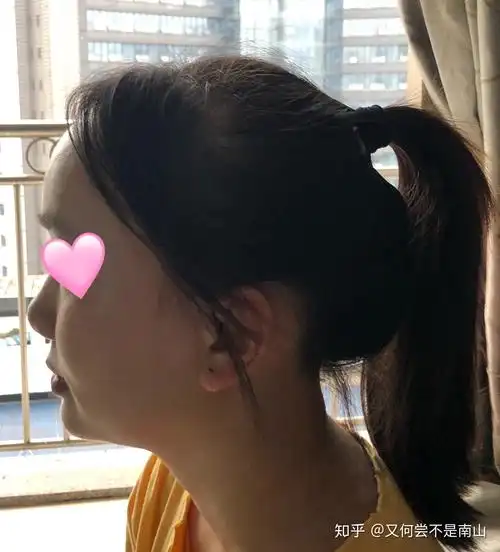 有一个超级扁平的侧脸是一种什么样的体验?