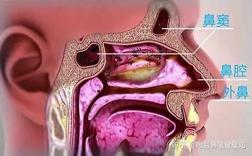 首大陈潜鼻子经常堵塞是什么原因