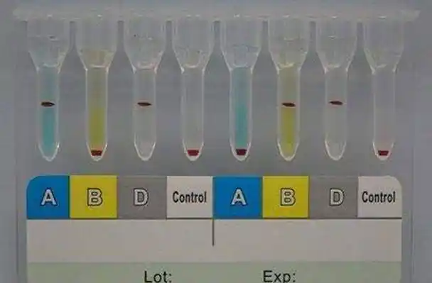 70亿分之一比中彩还难千倍唯一血型出现在中国江苏全球仅一例