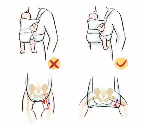 宝宝学步脚尖走路o型腿内八字正常吗
