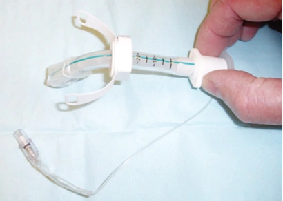 气管切开套管种类各异,护理有何不同?看这一篇!