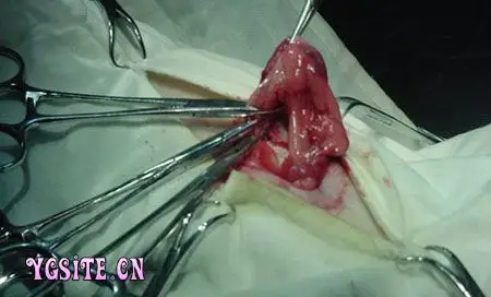 图解母犬绝育术[2]_牧医图谱_  阳光畜牧网-畜牧养殖-动物保健