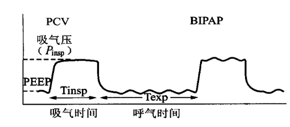 一文读懂呼吸机波形分析