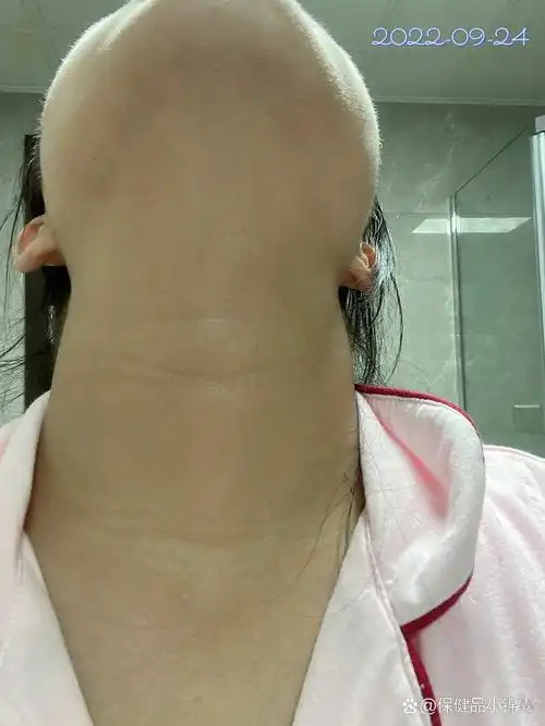 真的不是智商税|亲测有效 抱着试一试的态度入的