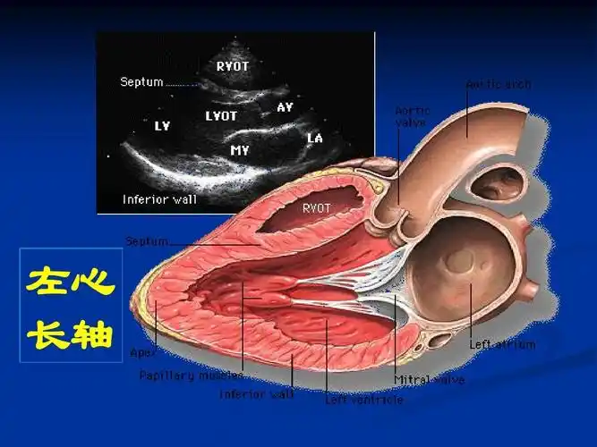 心脏超声诊断ppt