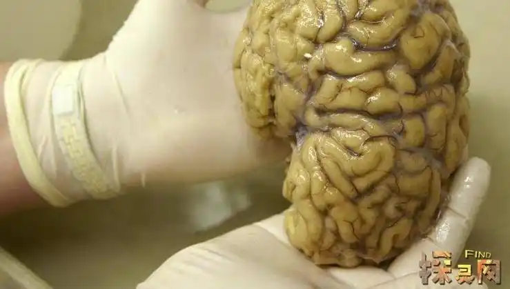人类的大脑其实很可怕爱因斯坦的大脑来来自外星人