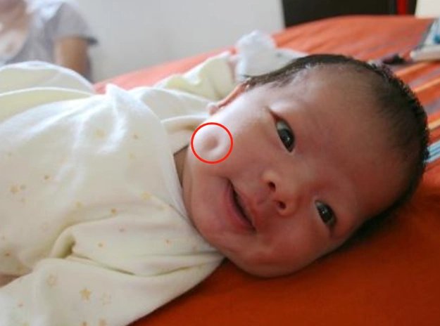 孩子长"拴马桩"能当官?