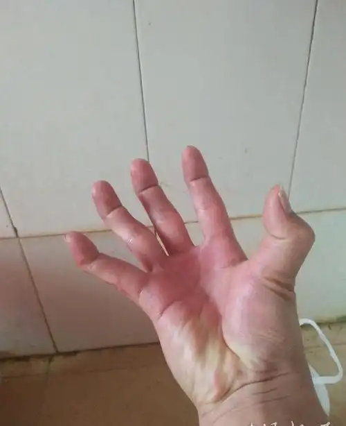 这些奇形怪状的手哪一张吓到你了