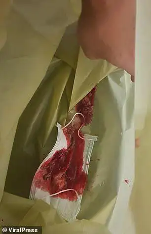 华人最爱去的这个国家沦陷了吸一口气吐出来的是血人们眼睛发红痛苦倒