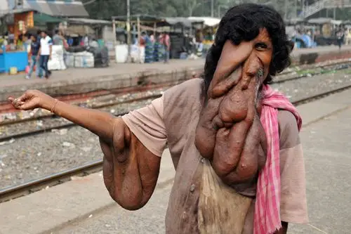 印度象人有「神」的长相 却是叫化子的命!