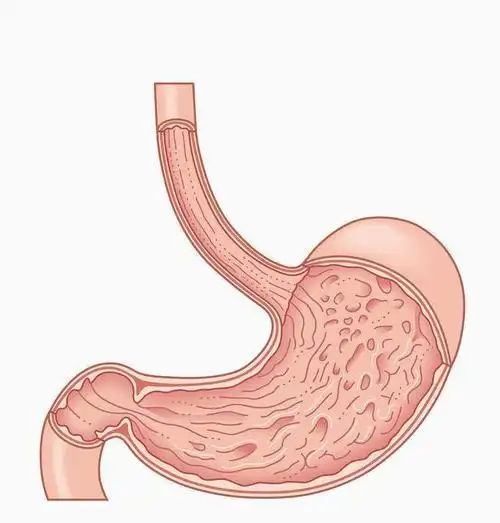急性腐蚀性胃炎疾病,严重损害患者胃部系统,且危及患者生命安全