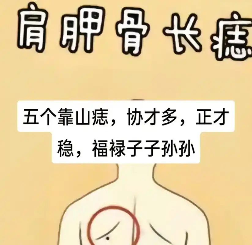 痣相图#面相 #相由心生 #看懂的都是高手 #掌纹的秘密 - 抖音