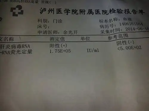 请问我这个丙肝好治吗?