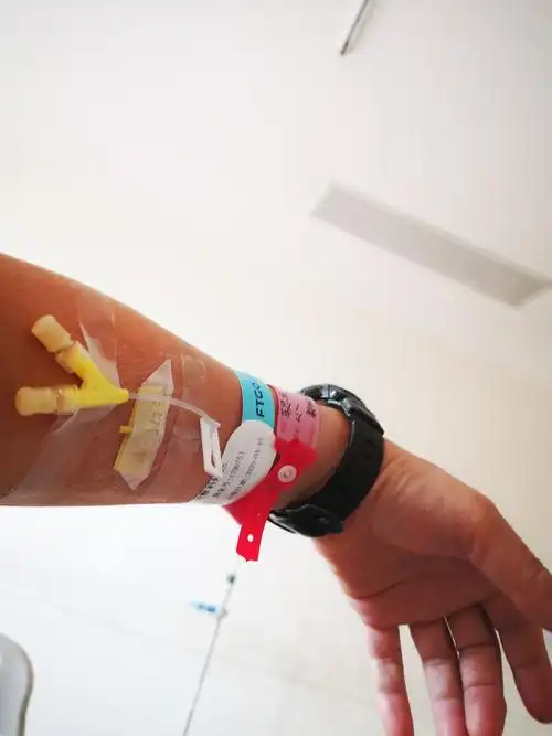 术前准备埋好的针.