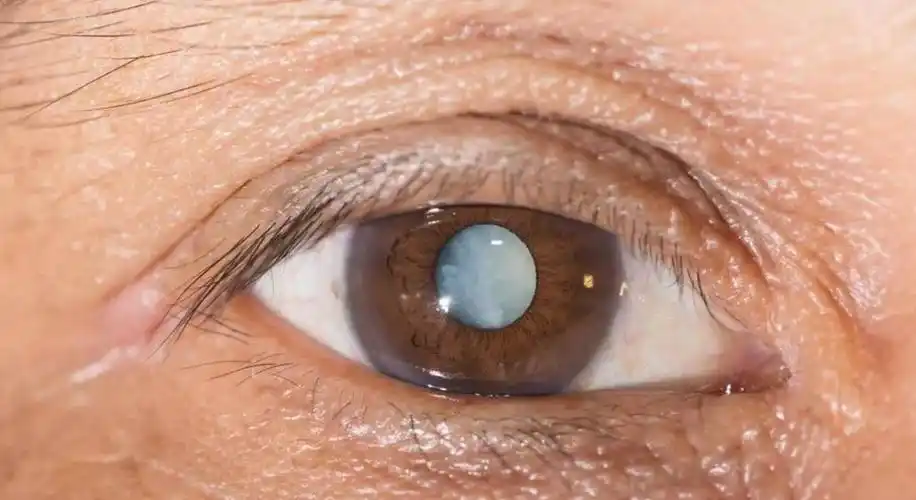 如何同时告别近视眼老花眼和白内障