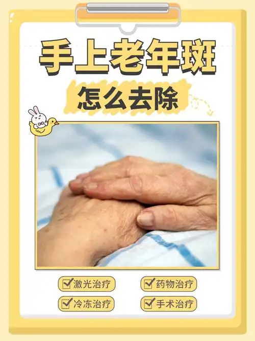 老年斑,医学上称为脂溢性角化病,是一种常见的良性皮肤病变