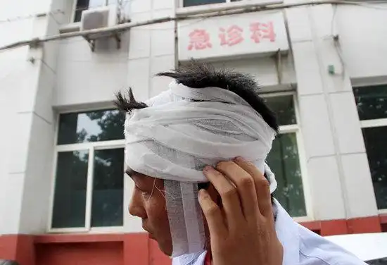 6月23日,记者在西电集团医院见到了受伤的小宋,小宋头上裹着纱布,手里