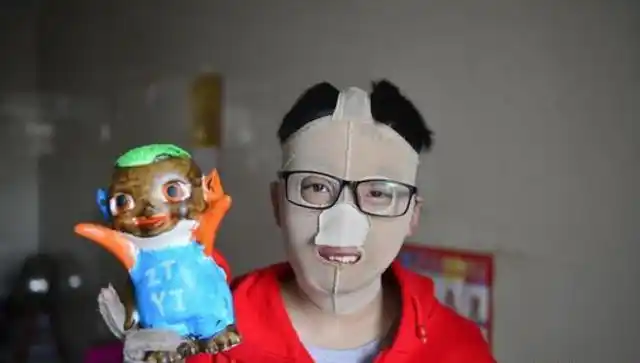 江西"面具男孩"饱受7年痛苦,今年参加高考:祝你早日实现梦想