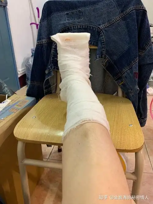 寝室坐在凳子上怀疑人生,然后去度娘问了问哈哈,本来觉得不用去医院