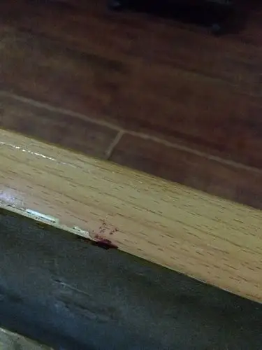 干枯的血液用洗衣粉能搽掉嘛