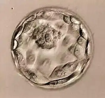 深度解析冻胚,鲜胚,囊胚,移植哪个可以一步到位?