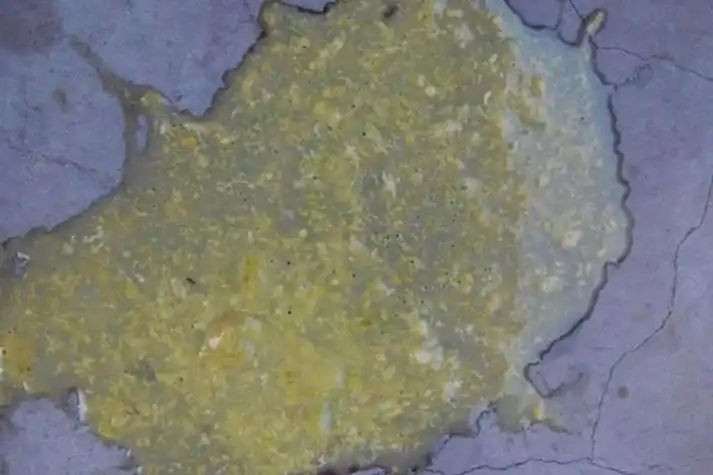 轮状病毒性肠炎大便图