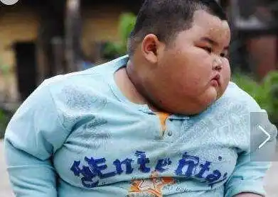 让人心疼的米其林宝宝1岁就重达45斤现在怎么样了