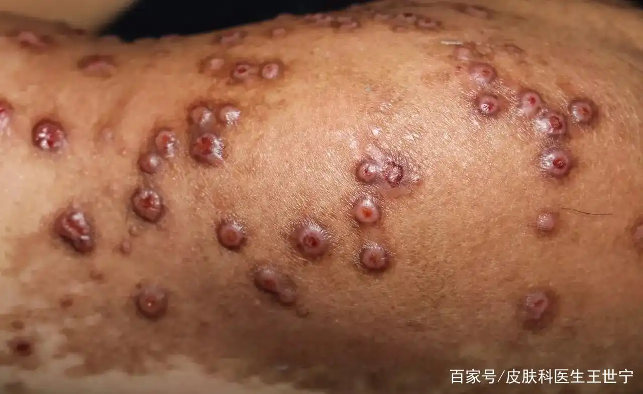 密集恐惧症者慎看