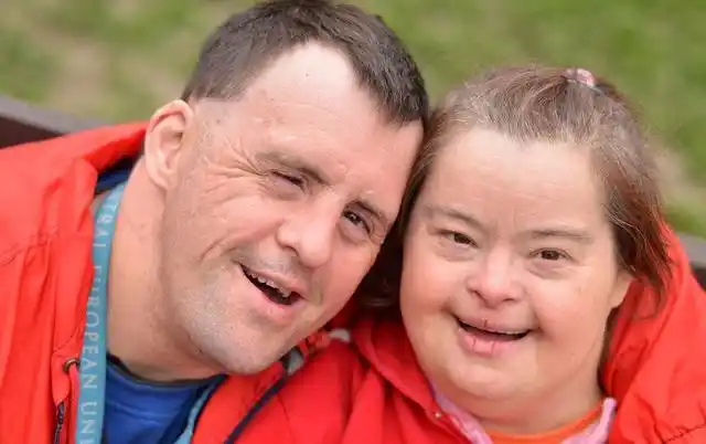 唐氏综合征又称21-三体综合征,先天愚型或down综合征,是一种染色体