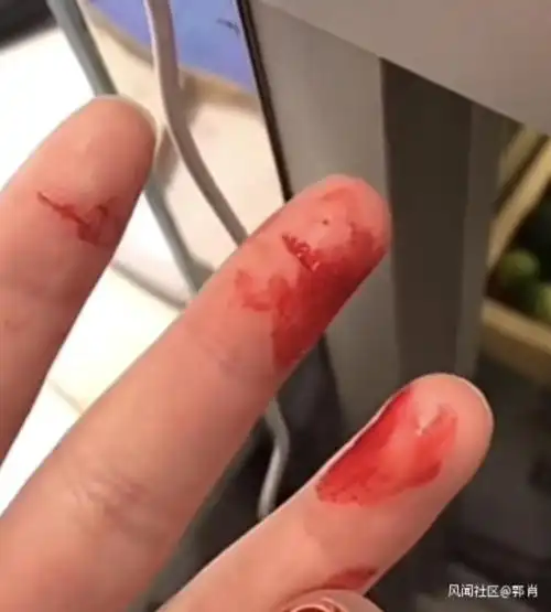 有未成年买家会用针刺,刀割的方式自残采血,制作血吊坠送恋人,商品