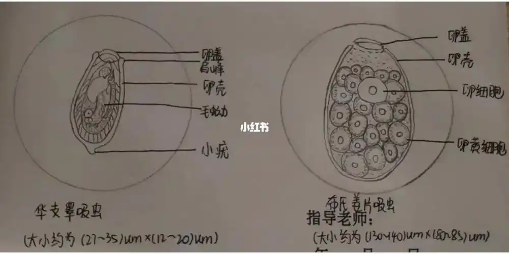 医学生   #医学生的日常  #寄生虫  #华支睾吸虫  #布氏姜片吸虫