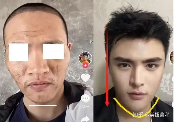 或者说压根不应该做的项目~需要避坑:垫下巴 微笑唇~求求了,男生就不